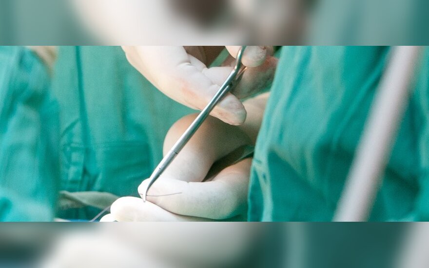 chirurginis erekcijos gydymas